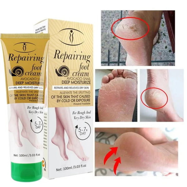 Aichun Beauty Repairing Foot Cream - Divine Beauty